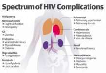 Чверть людей, які живуть з ВІЛ у Великобританії, є все ще невиявленою