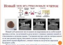 Стовбурові клітини для відновлення зору — новий спосіб доставки