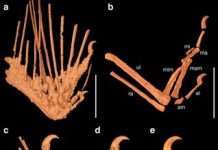 Вчені знаходять рано імунний спусковий механізм MS